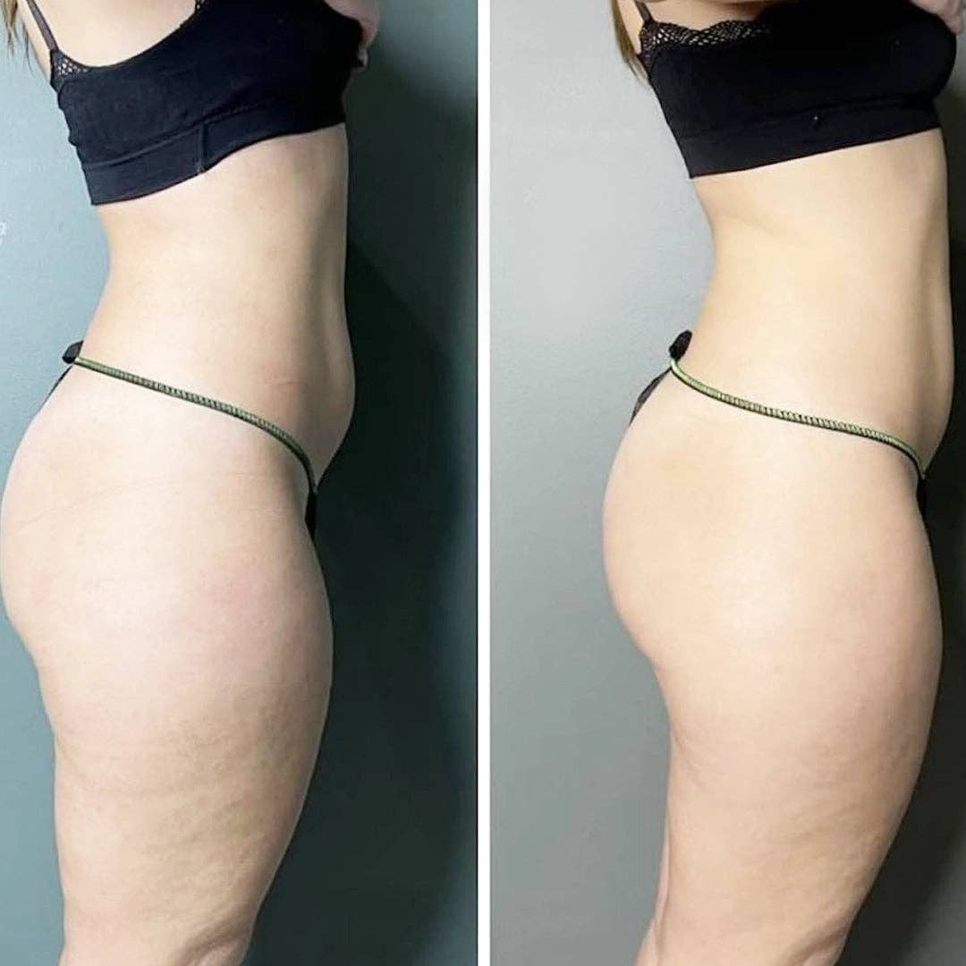 DETOXIFYING & SLIMMING Peel-Off BODY MASK